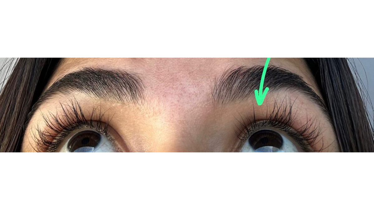 Before - Nikolle