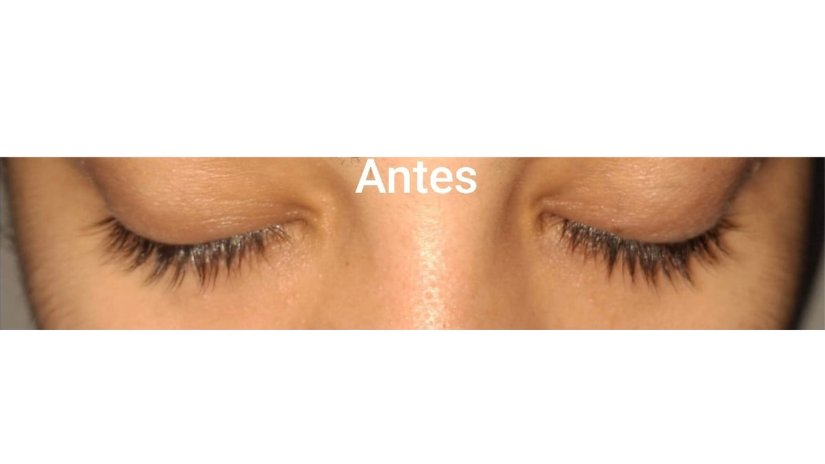 Before - Valeria